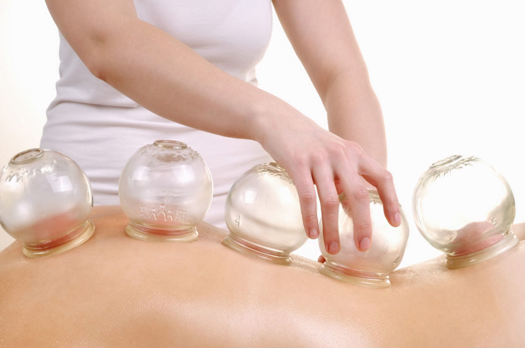 cupping and massage